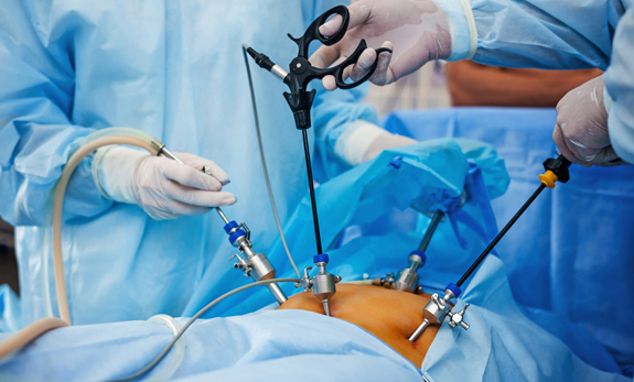 Laparoskopi'ye Genel Bakış